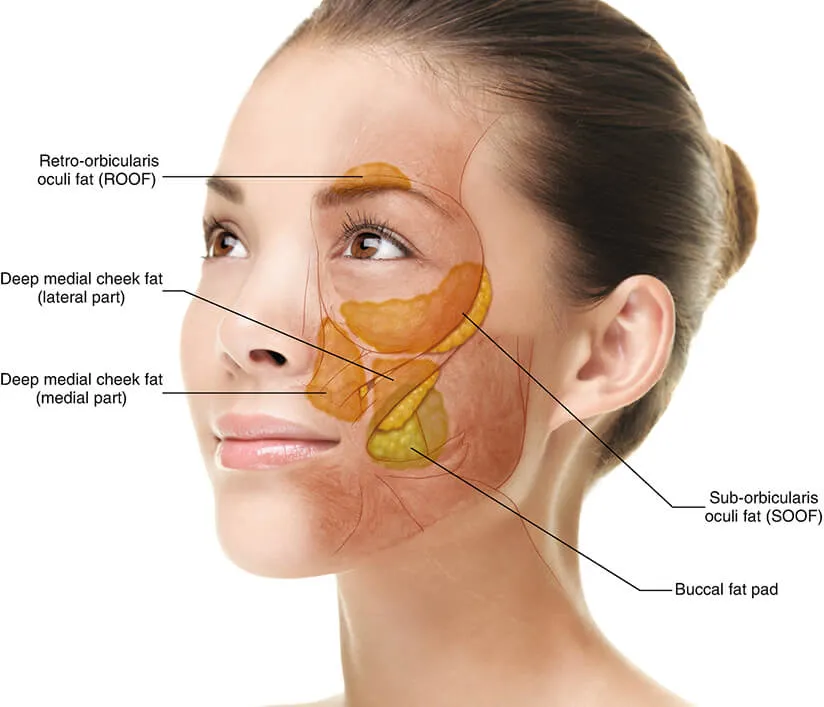 Diagram showing the location of the buccal fat pad in the cheek.