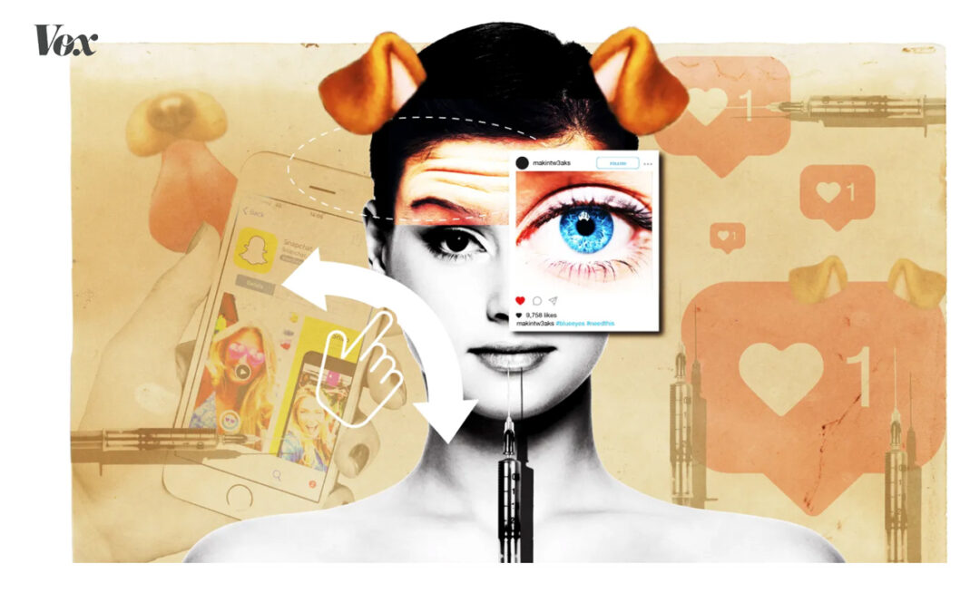 “Snapchat dysmorphia”: why people are getting plastic surgery – Vox