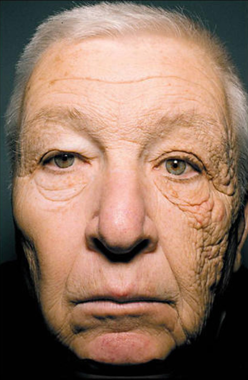 Causes of Aging